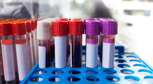 Blood Collection Tubes